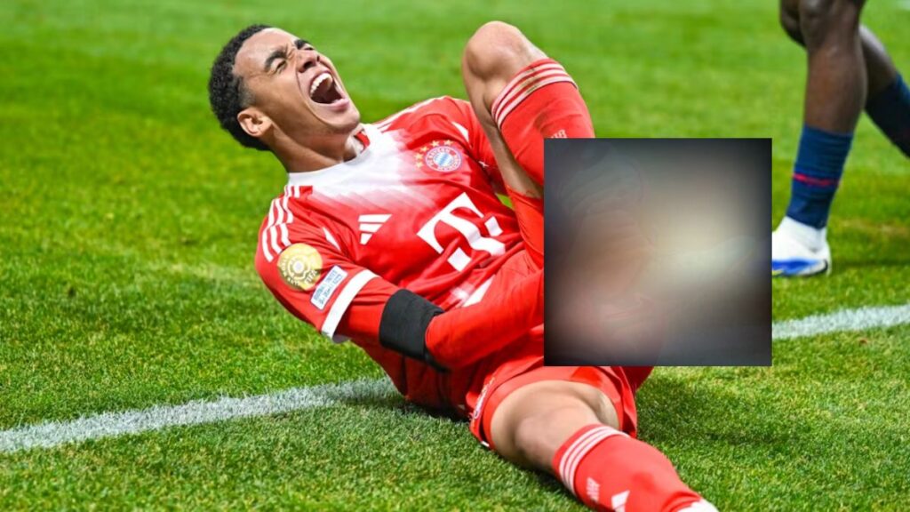 Images spectaculaires de la jambe retournée de Jamal Musiala Fracture du péroné et luxation de la cheville face au PSG